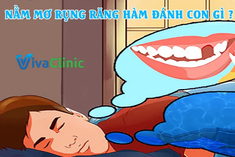 giấc mơ rụng răng hàm