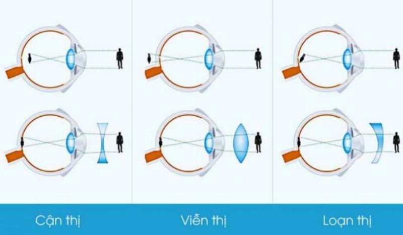 Ảnh mờ nhòe so sánh với ảnh đã tăng độ nét cho ảnh, thấy rõ khác biệt về chi tiết.